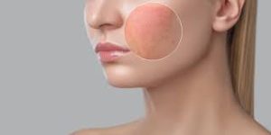 Dermatologists